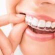 The-Role-of-Retainers-After-Invisalign-Treatment