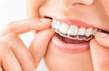 The-Role-of-Retainers-After-Invisalign-Treatment