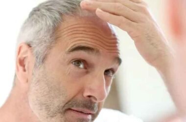 What-Surprising-Options-Are-Tampa-Bay-Residents-Using-to-Tackle-Hair-Loss