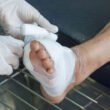 How Expert Diabetic Wound Treatment in Downriver Helps Prevent Serious Complications