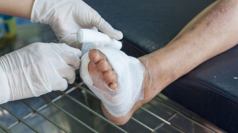 How Expert Diabetic Wound Treatment in Downriver Helps Prevent Serious Complications