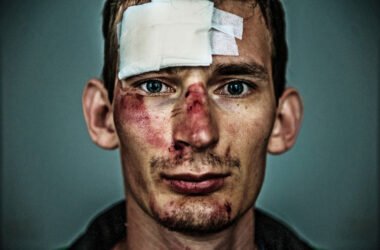 Possible Personal Injury Legal Case