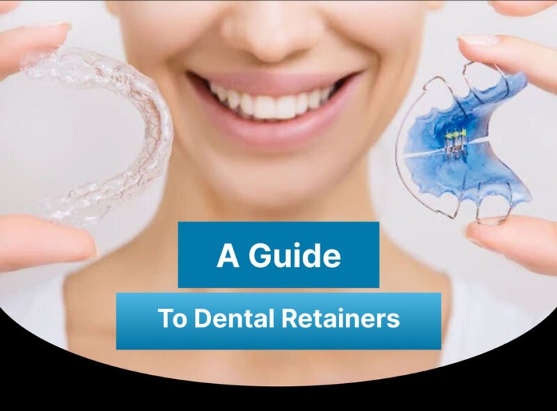 Understand Why Patients Require Bite Splints With Insight From Dentists in Ann Arbor