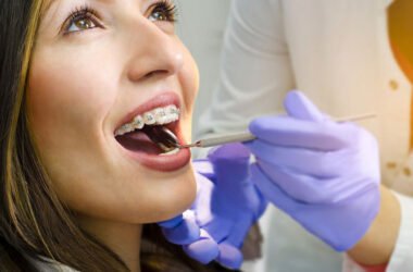 7 Reasons Families Choose a Johns Creek Orthodontist for Braces & Aligners